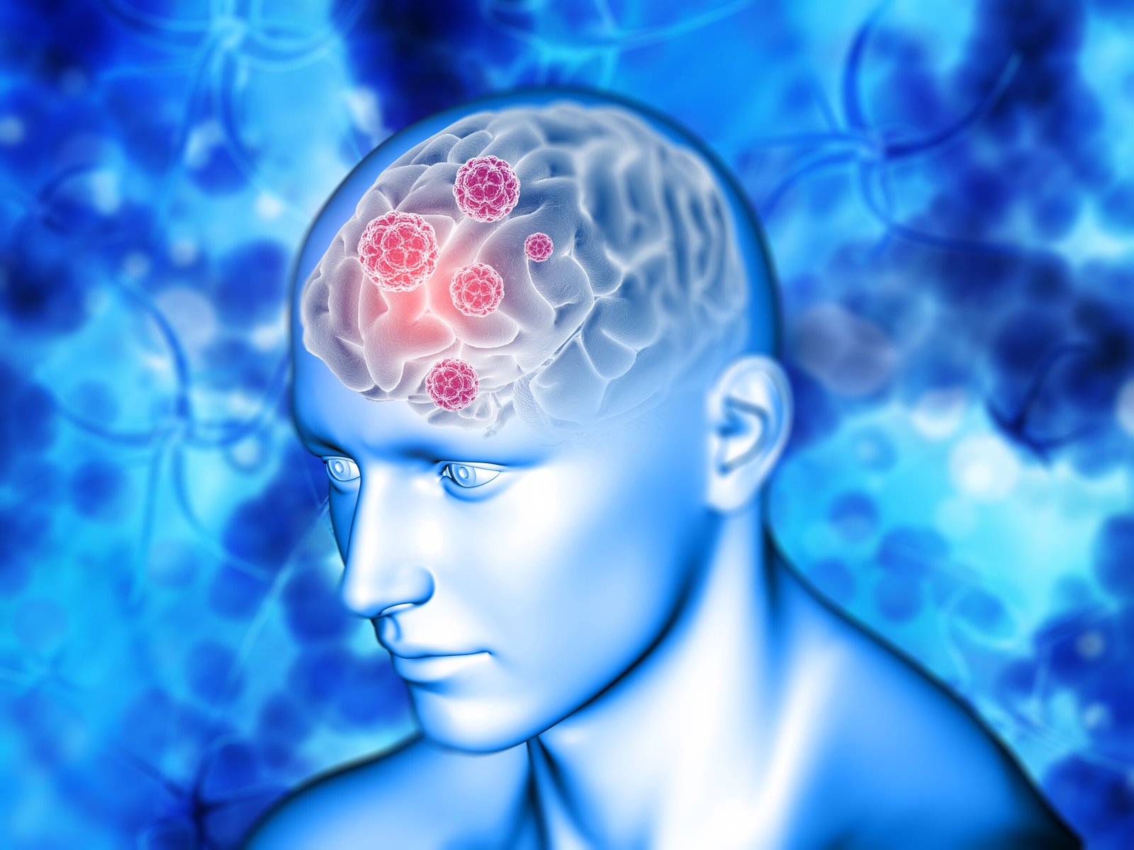 3D render of a medical background with virus cells on brain highlighted