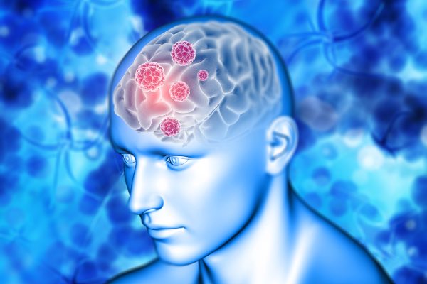 3D render of a medical background with virus cells on brain highlighted